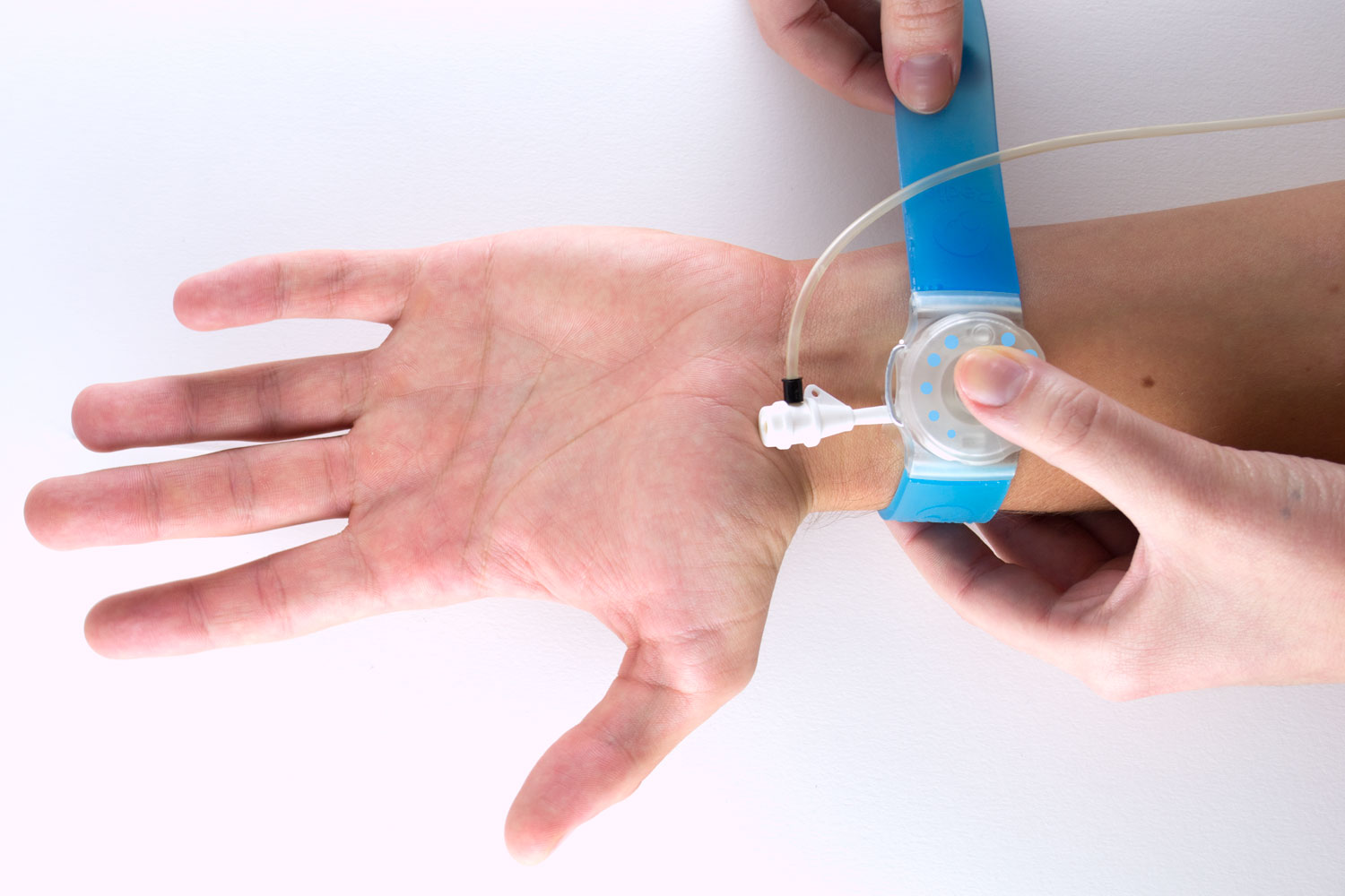 Radial Hemostatic Device by Zanocchi & Starke Architizer